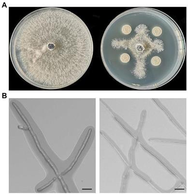 Biocontrol activity of Bacillus halotolerans strain Pl7 against Botryosphaeria dothidea causing apple postharvest decay and potential mechanisms